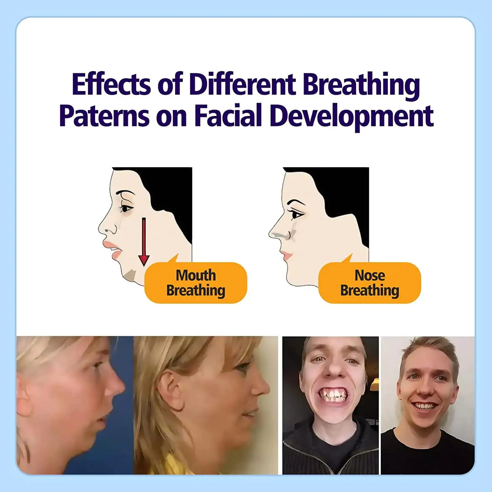 30Pcs/תיבת אנטי-נחירות מדבקות ילדים למבוגרים לישון לילה השפתיים האף נשימה לשיפור תיקון הפה תיקון אנטי-נחירות מדבקה - 1