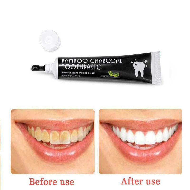 2019 פחם במבוק משחת שיניים הלבנת שיניים שחורות מסיר כתמי השן אכפת לי - 5
