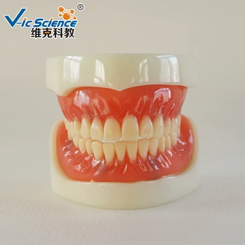מלאה שיניים תותבות שתל דגם/שתל דגם/תותבות שיניים שיניים המודל